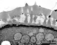 interapertural area of pollen wall