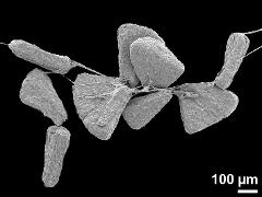 massulae,part of pollinium