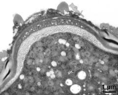 apertural area of pollen wall