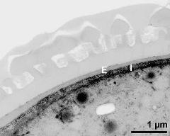 interapertural area of pollen wall, intine (I), endexine (E)