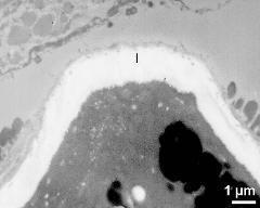 apertural area of pollen wall, intine (I)