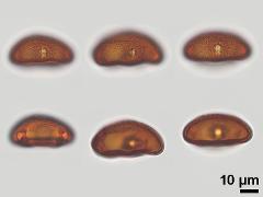 acetolyzed pollen,equatorial view