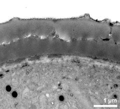 pollen wall; interapertural area