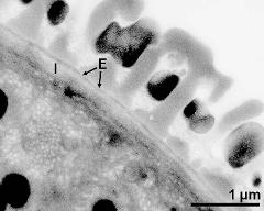 interapertural area of pollen wall