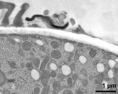 pollen wall at transition of aperture and interapertural area