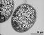 pollen grain in cross section