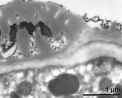 pollen wall at transition of aperture and interapertural area