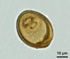 acetolyzed pollen,equatorial view