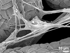 elastoviscin connecting massulae