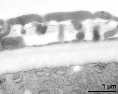 interapertural area of pollen wall