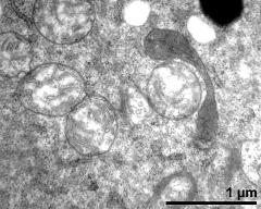 vegetative cytoplasm with organells