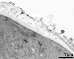 pollen wall at transition of aperture and interapertural area