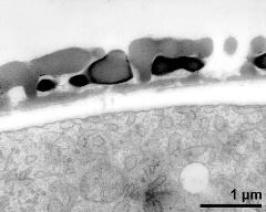 interapertural area of pollen wall