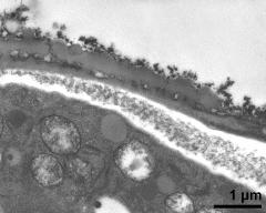 pollen wall at transition of aperture and interapertural area