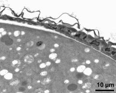 pollen wall at transition of aperture and interapertural area