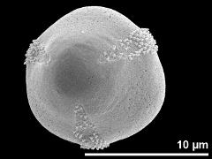 polar proximal view