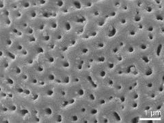 acetolyzed pollen,exine surface