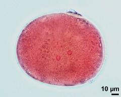 pollen grain with two sperm cells