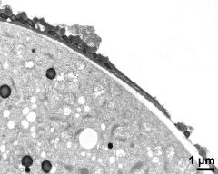 pollen wall at transition of aperture and interapertural area