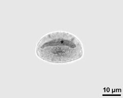 pollen grain with generative cell (asterisk) and vegetative nucleus