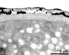 interapertural area of pollen wall