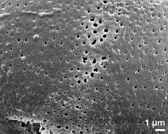 exine surface in equatorial area