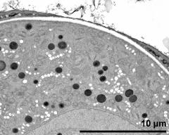 apertural area of pollen wall