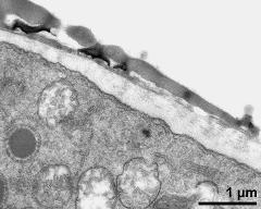 pollen wall at transition of aperture and interapertural area