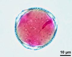 pollen grain with generative cell