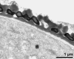 pollen wall, interapertural area