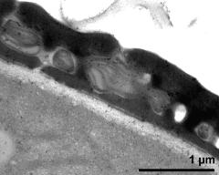 interapertural area of pollen wall