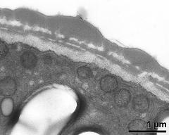 pollen wall, interapertural area