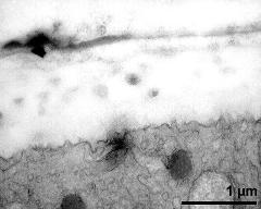 apertural area of pollen wall