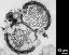 monads in cross section (protrusions with operculum marked by asterisk)