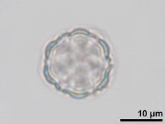 polar view,acetolyzed pollen