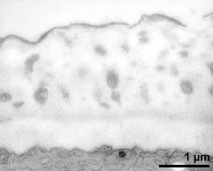 apertural area of pollen wall