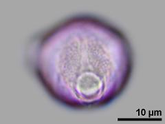 equatorial view,hydrated pollen