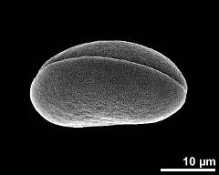 dry pollen grain in slightly oblique polar view (distal)