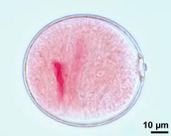 pollen grain with sperm cell (left) and vegetative nucleos (right)