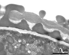 pollen wall; interapertural area