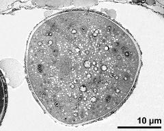 cross section of pollen grain