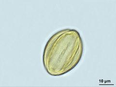 acetolyzed pollen,equatorial view