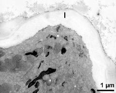 apertural area of pollen wall, intine (I)