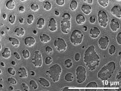 exine surface