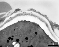 apertural area of pollen wall