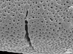 acetolyzed pollen,aperture