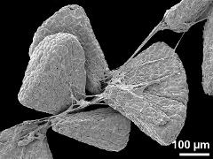 massulae,part of pollinium