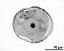 pollen grain in cross section