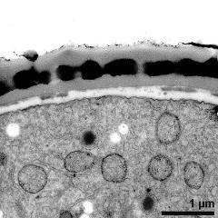 interapertural area of pollen wall