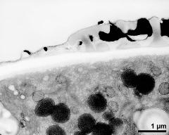 pollen wall at transition of aperture and interapertural area